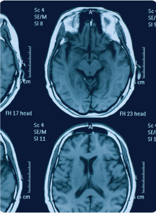 A scan shows the anatomy of a person's brain.