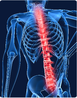 Image shows anatomy of a person's spine.